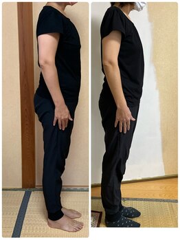 リンドール(RinDoll)/40代女性ダイエット/耳ツボ/痩身