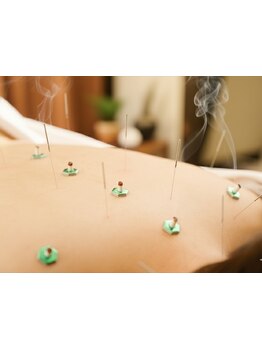 鍼灸施術を受けたい