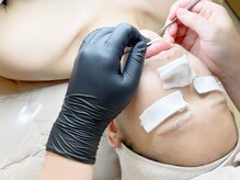 ユーエステティック(U AESTHETIC)