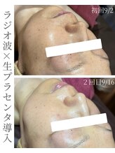 シストワ(sistoi)/衰えた細胞を元気に若々しく☆