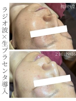 シストワ(sistoi)/衰えた細胞を元気に若々しく☆