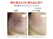 ダーウィン(Darwin)/鏡を見るたびに落ち込む日々