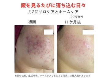 ダーウィン(Darwin)/鏡を見るたびに落ち込む日々