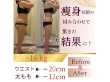 イーズ ミュゼ &nbsp;ららぽーと横浜店の雰囲気（腹部はもちろん気になる部位、落ちにくい脂肪へアプローチ）