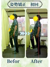 アミーゴ整体院/ビフォーアフター