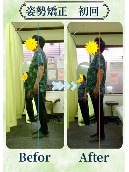 アミーゴ整体院/ビフォーアフター