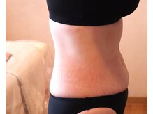 アーユルヴェーダ痩身サロン サムサラ(SAMSARA)の雰囲気（AFTER⇒毎回体重をしっかり落とす!見た目で分かるサイズダウン♪）