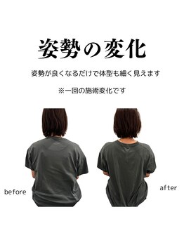 整体院チルアンドママ(CHILL&mama)/姿勢の変化