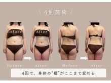 マリーズウィル(MARY's WILL)の雰囲気（体重は変わらなくても、身体のラインはここまで変わる。）