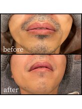 ファブ 鈴鹿店/お客様ビフォーアフター