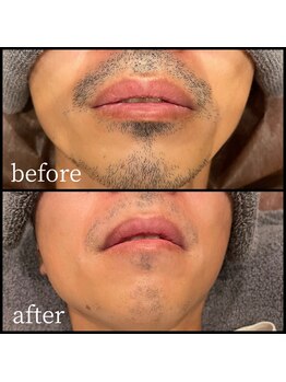 ファブ 鈴鹿店/お客様ビフォーアフター