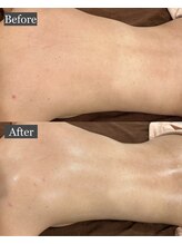 ルヴィカカリーナ(REVI Cacalena)/