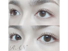 ラン(RAN)/ラッシュリフト