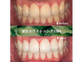 フタバ 天神大名店(futaba)