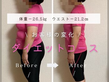 ニューバース 長崎 浜町(New Birth)/お客様ビフォーアフター