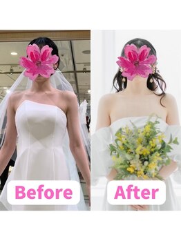 すみれ鍼灸整骨院/神戸 ブライダル美容整体