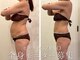 ニコ(nico)の写真/第二弾★セルライトZEROモニター募集♪効率良く徹底全身痩せ!集中ケアで理想のメリハリ美ボディへ