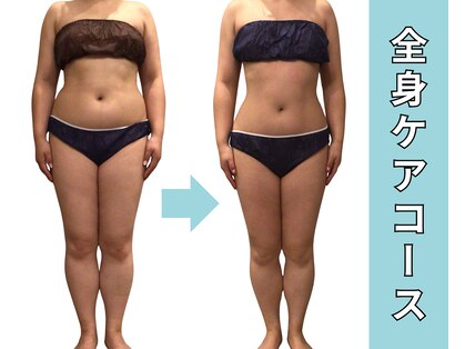 プラマイル(Pramile)の写真