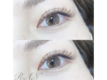 ラン(RAN)/フラットラッシュ