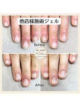 他店様オフ(無料)+自爪育成