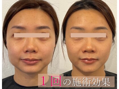 小顔製作所 心斎橋院の写真