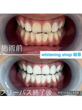 ホワイトニングショップ 岐阜駅前/#岐阜ホワイトニング#岐阜エステ