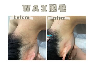 レヴィート(Revept)/【ワックス脱毛】