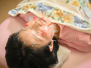 花うさぎ鍼灸院/美容鍼灸重点コース
