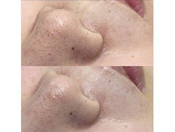 ハイク バイ ジェン(HIKE by gen.)/フェイシャルワックス