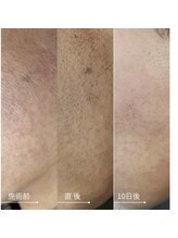 メディカルエース(MedicalAce)/スポット