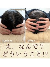スウ(suu.)/Before-After【40代】7回