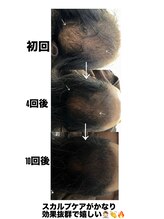 エクラ(ECLAT)/最新スカルプヘアで悩み解決！