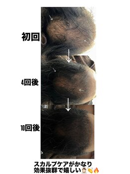 エクラ(ECLAT)/最新スカルプヘアで悩み解決！