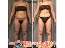 ボディエステティック アクアオーラ 富山店/-12キロ！綺麗にやせる！