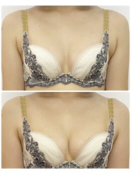 ラビス(RAVIS)/20代☆谷間くっきり美胸完成♪