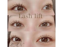 ラン(RAN)/ラッシュリフト