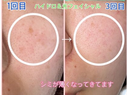 ララン(Laran)の写真