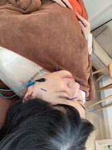 ハリファ鍼灸院 横浜関内院(HariFa鍼灸院)/美容施術