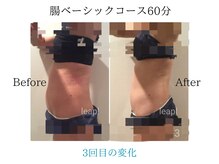 リープル(Leapl)/【腸もみ】腸もみ後の変化写真