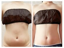 美容整体カラダリメイク(karada)の雰囲気（【実績多数★骨盤セル脂肪燃焼】美肌もサイズダウンも最速で叶う）