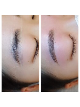 エフ デザイン(eF design)/ビフォーアフター