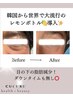 新メニュー！話題の脂肪分解剤レモンボトル（目の下の脂肪，マリオットライン