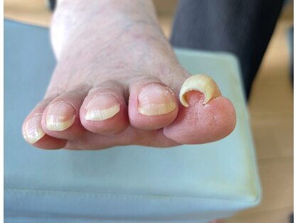 巻き爪じゅん 船橋店の写真