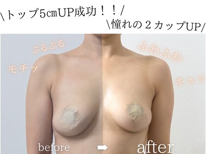 キャニー(cany)の写真