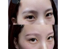 ブリス 姫路(Bliss)/お客様Before/After 