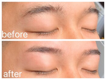 クラシックス(CLASSICS)/眉脱毛before&after