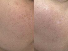 マハロ(mahalo)の雰囲気(肌改善♪ドクターズコスメ正規取扱店)