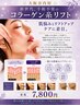 【新規】大阪市内初！コラーゲン糸リフト｜引き上がる！ハリ弾力｜