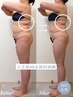 【ポッコリお腹・背中肉ケア】上半身集中痩身2回体験60分　通常価格￥52,800→