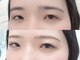 ヴィヴィッド グロウ(VIVID GLOW)の写真/《まつげ・眉の悩みを解決》逆さまつげ・薄さ・眉の悩みまで、目元全体を美しく改善